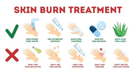 burns and scalds how to treat