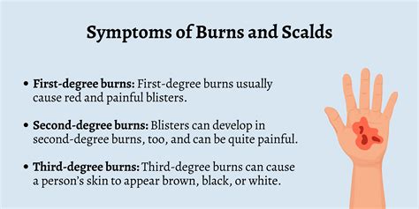 burns and scalds symptoms
