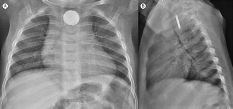 Button Battery Ingestion Dog