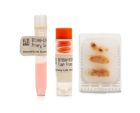 Awasome Buy Human Tissue Samples Ideas