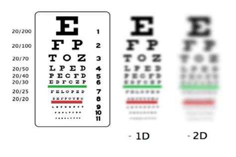cách tính độ cận thị của mắt ở nhật
