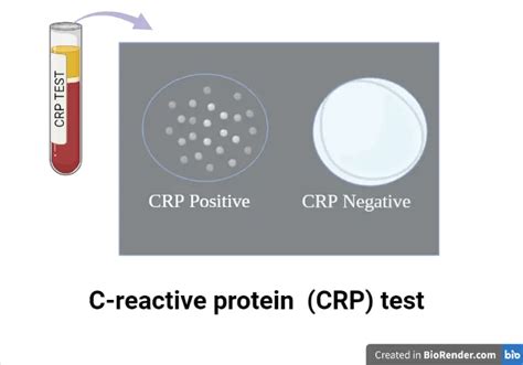 Understanding the C Reactive Protein CRP Test Explained