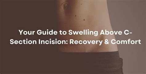 C Section Shelf Or Swelling