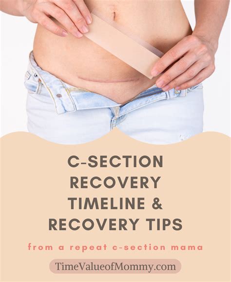 Recovering with Ease: A Comprehensive Guide to C-Section Surgery Recovery Time and Tips