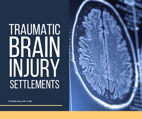 california brain injury law resources