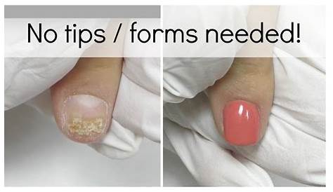 Can Acrylic Nails Cause Acne Do s Really Damage Your ? Salons