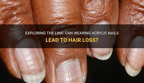 Can Acrylic Nails Cause Hair Loss How To Remove Easily At Home