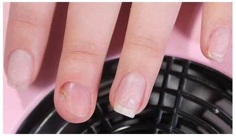 Can Acrylic Nails Cause Headaches Do s Really Damage Your ? Salons