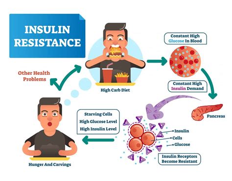 What is insulin sensitivity and resistance?