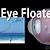 can eye floaters block vision