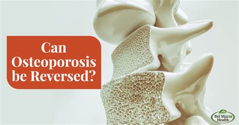 can osteoporosis be reversed naturally