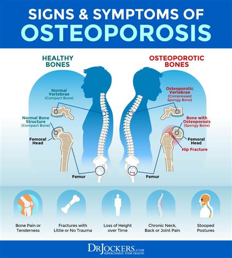 can osteoporosis cause pain in joints