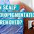 can scalp micropigmentation be removed
