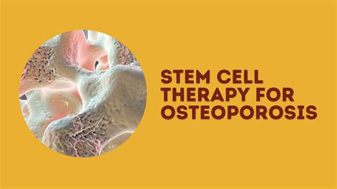 can stem cells help osteoporosis