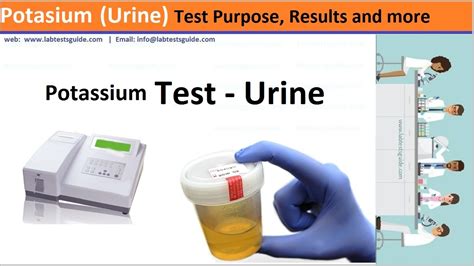 Potassium urine test
