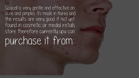Shrink a pimple with acetone. (Picture only with how to) Blackheads