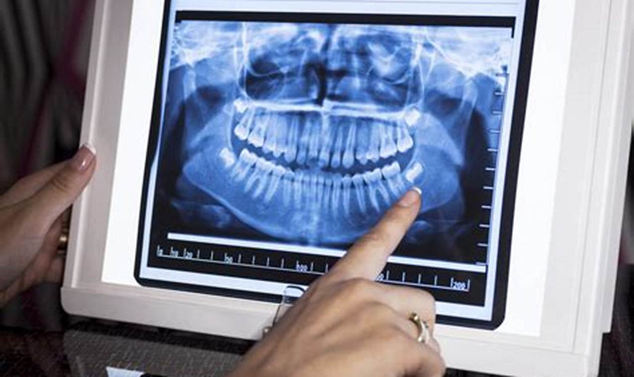 Unveiling Your Dental X-Ray Rights in Florida: Uncover the Secrets Today!