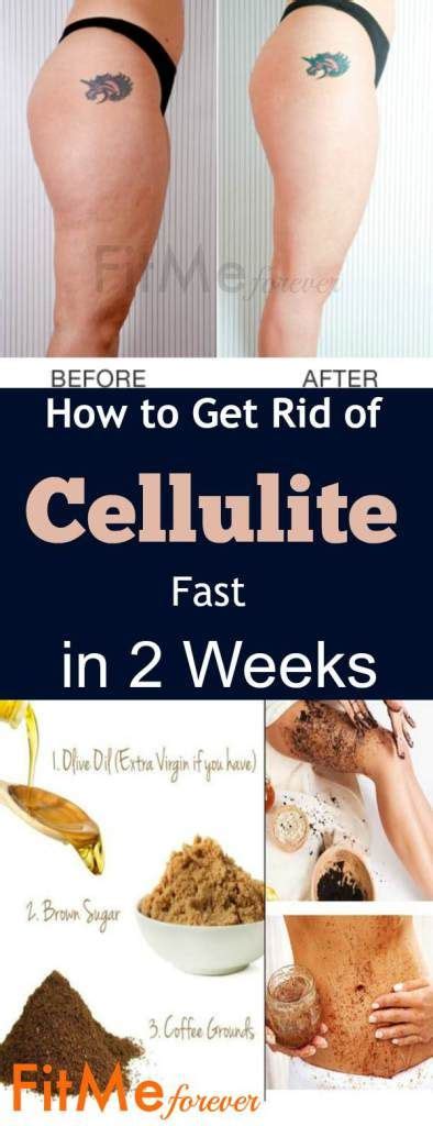 can you smooth out cellulite