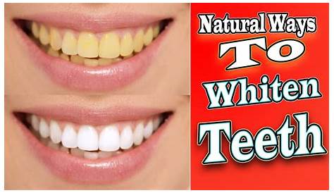 How to Whiten Kids Teeth? 4 Easy Home Methods After SYBIL