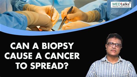 can a biopsy cause cancer to spread