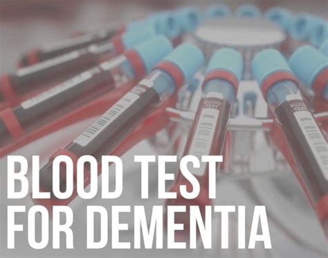can a blood test detect alzheimer's