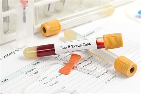 can a blood test detect ascites