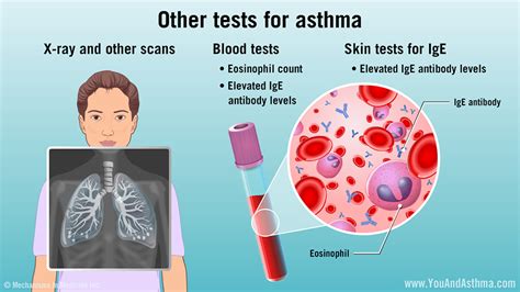 can a blood test detect asthma