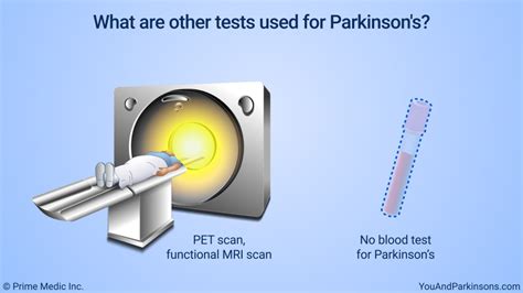 can a blood test detect parkinson's