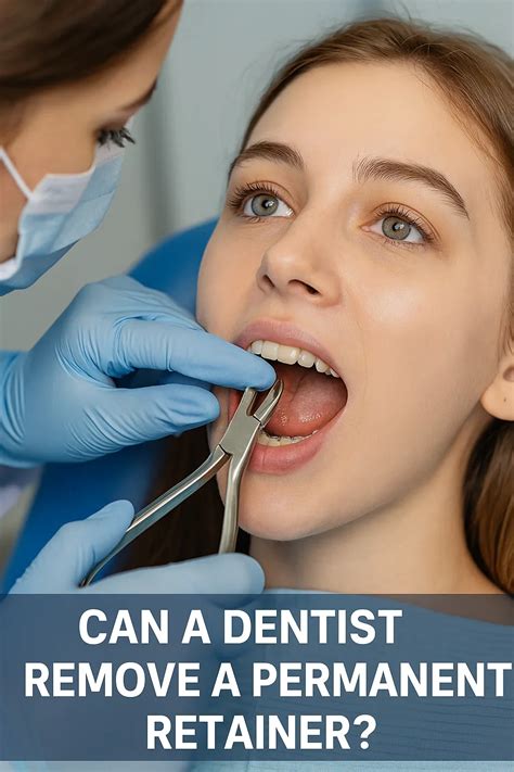 Can A Dentist Replace A Retainer