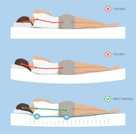 Can A Too Soft Mattress Cause Sciatica