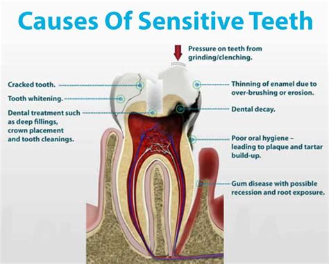 can a tooth infection cause tooth sensitivity