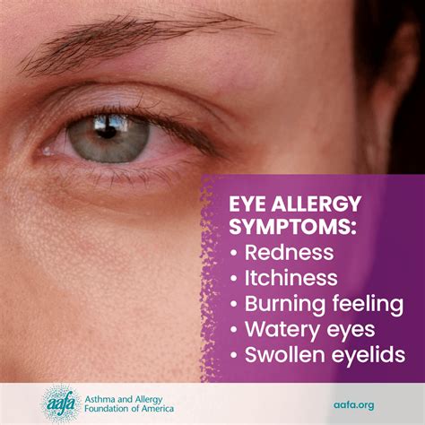 can allergies make your eyes blurry