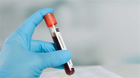 can als be detected in blood work