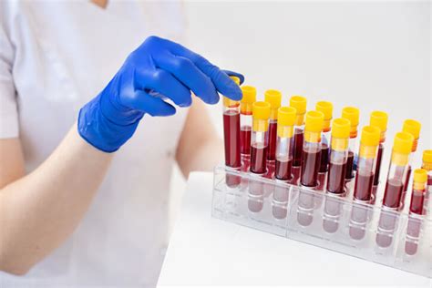 can blood test detect stomach cancer
