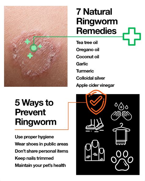 Can Colloidal Silver Help With Ringworm
