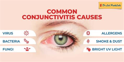 can conjunctivitis cause sore throat