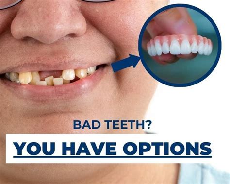 Be Your Own Dentist! See How To Remove The Plaque From Teeth In Just 5