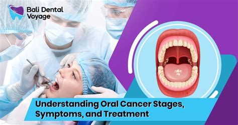 10 steps to perform an oral cancer screening Dentistry IQ