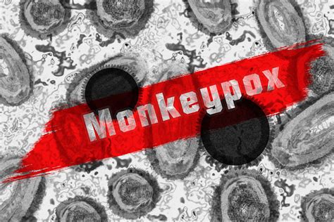 Discover 5 Insights can dogs get monkeypox Your Pet's Safety