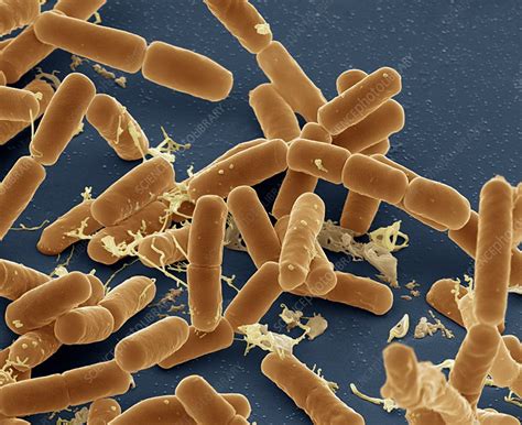 Can E Coli Be Seen Without A Microscope