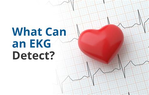 can ecg detect heart conditions
