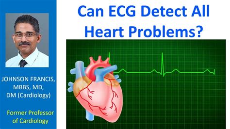 can ecg detect heart problems