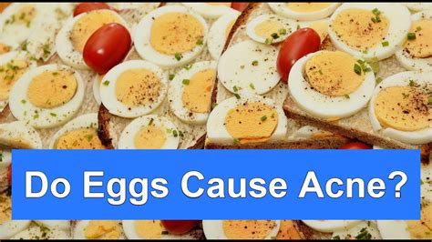 Can Eggs Cause Acne? The Truth Behind the Link