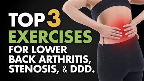 can exercise help arthritis in back