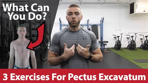can exercise help pectus excavatum
