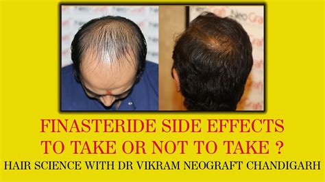 can finasteride cause low blood pressure