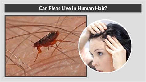 Can Fleas Live In Dreadlocks