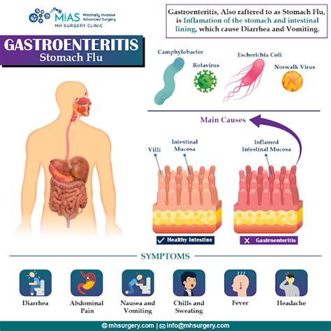 can gastroenteritis cause sepsis