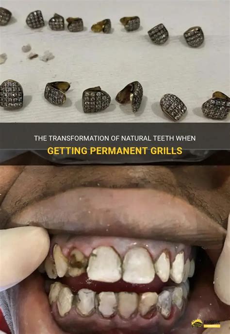 Can Grills Be Permanent