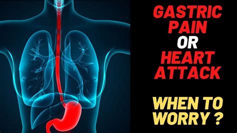 Can Heart Issues Cause Gastric Problems